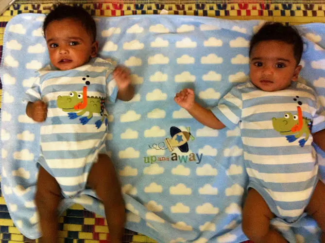 Two infants, twins, both in matching blue onesies, are pictured lying down on the bed, looking at the camera. They were born after ICSI treatment to their parents in 2009 at Karthika Dattas IVF, Vijayawada.